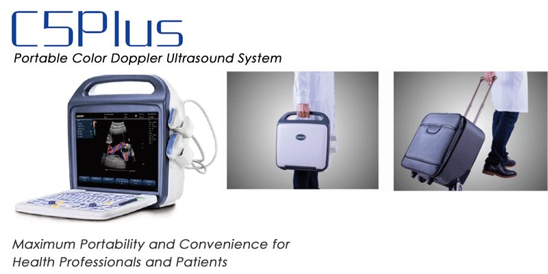 Portable Color Doppler Ultrasound System – C5Plus